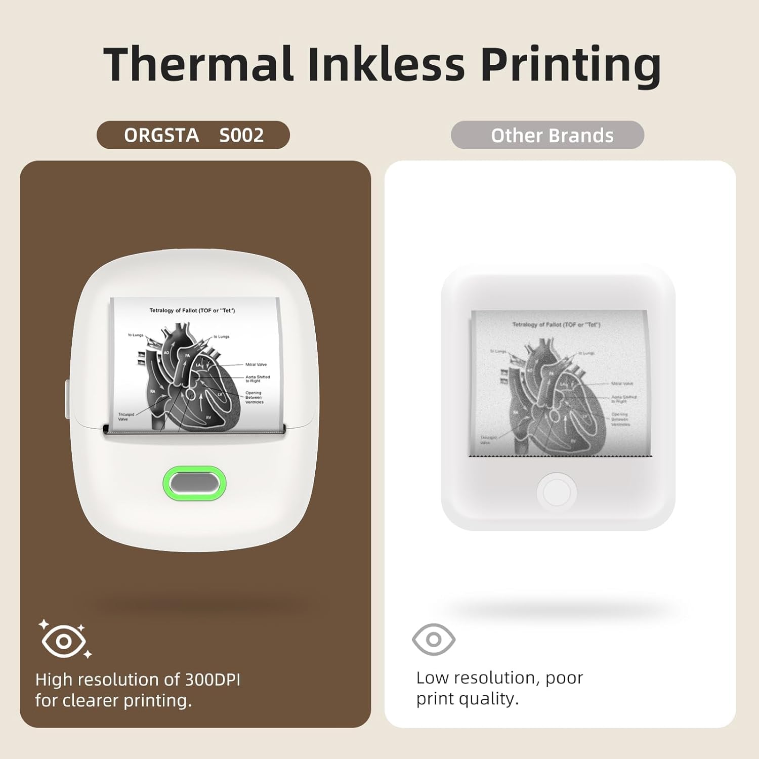 Orgsta S002 Etichettatrice Bluetooth Portatile 300 Dpi - immagine 5