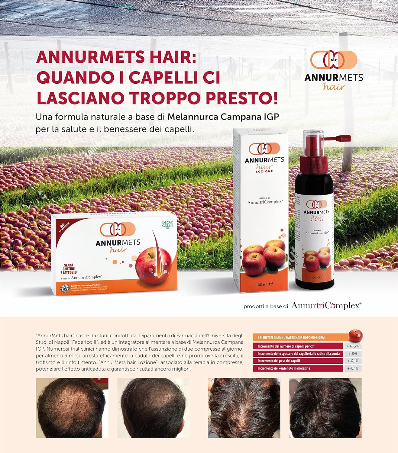 NGN HEALTHCARE-NEW GEN.NUT.Srl Annurmets Hair Compresse - immagine 3