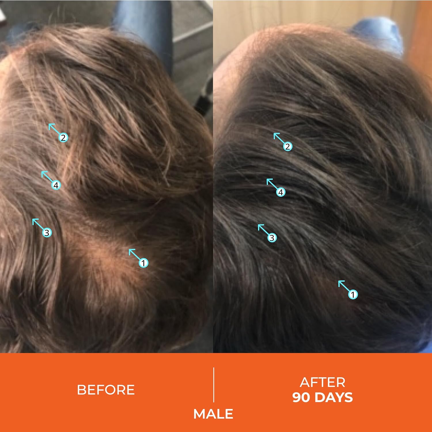 Ds Laboratories Revita Balsamo per Capelli Diradati 925ml - immagine 4