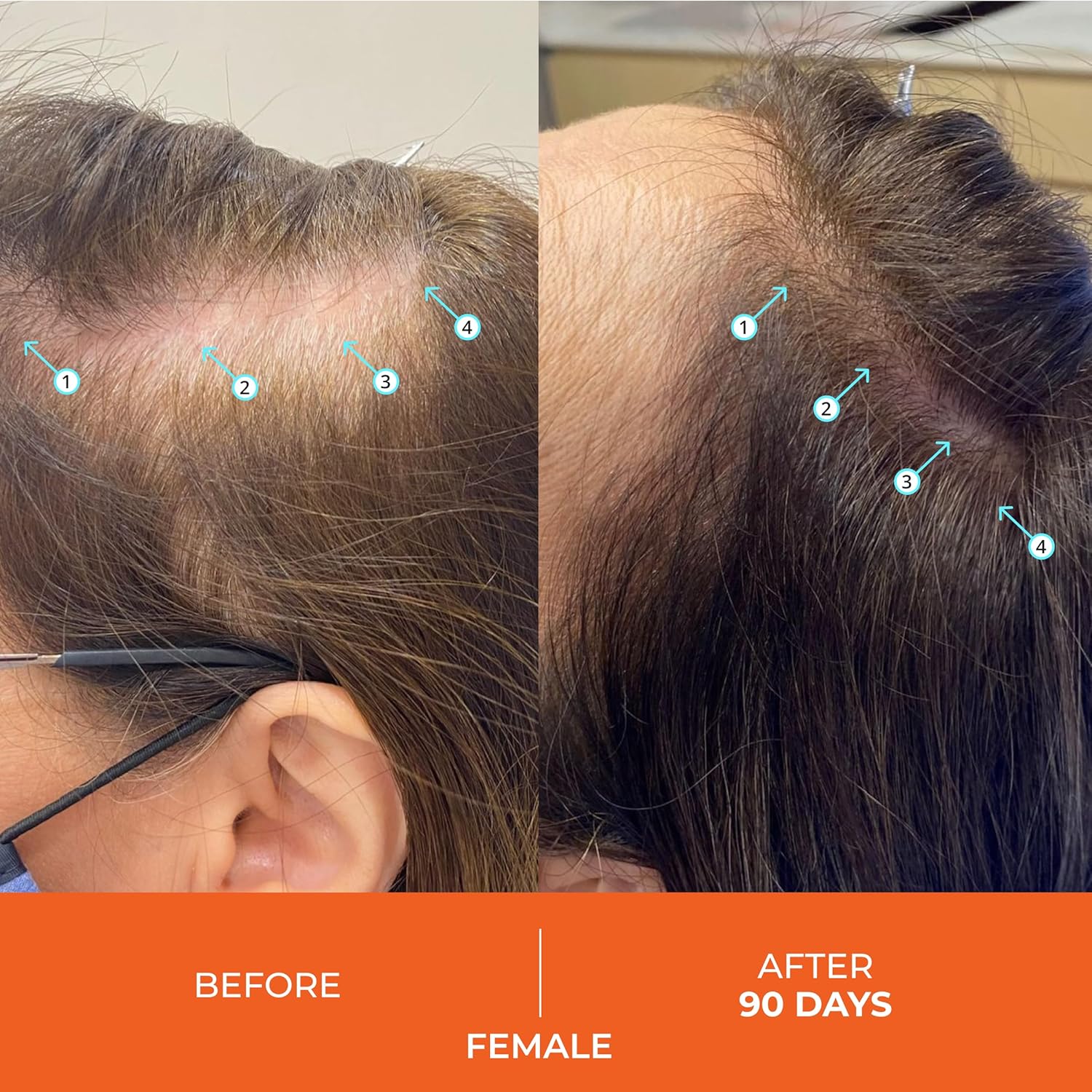 Ds Laboratories Revita Balsamo per Capelli Diradati 925ml - immagine 5