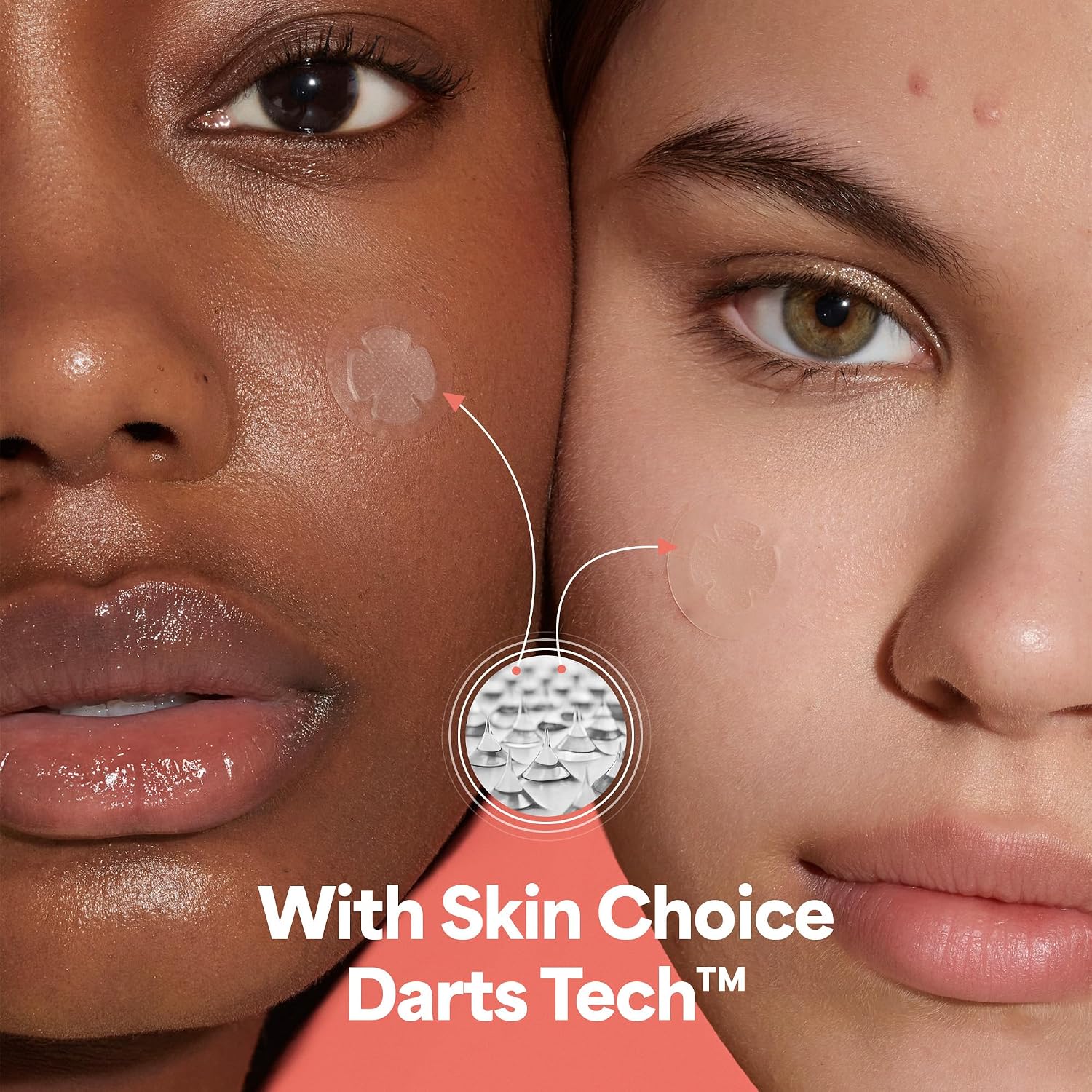 SKIN CHOICE Microdart Patch Brufoli con Acido Salicidico, Olio dell ...