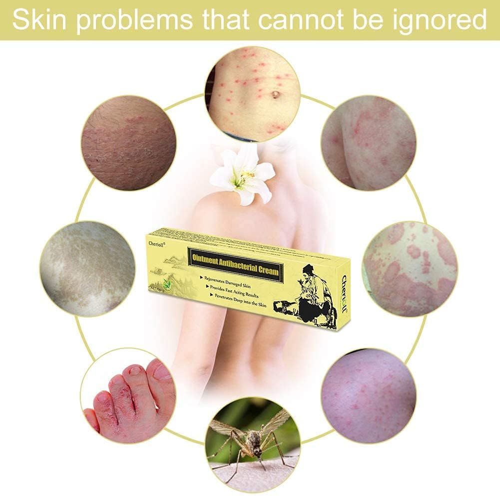 Lutateo Crema Idratante Naturale per Acne e Psoriasi - immagine 4