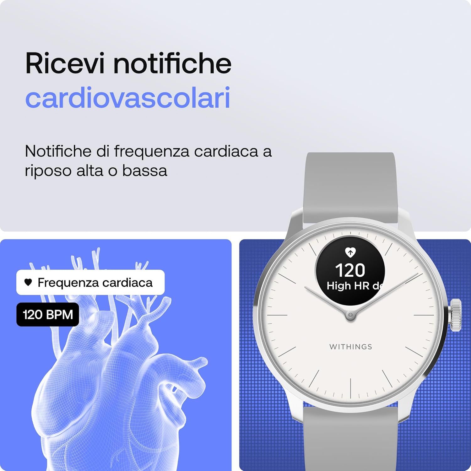 Withings ScanWatch Light - Smartwatch Ibrido 30 giorni - immagine 3