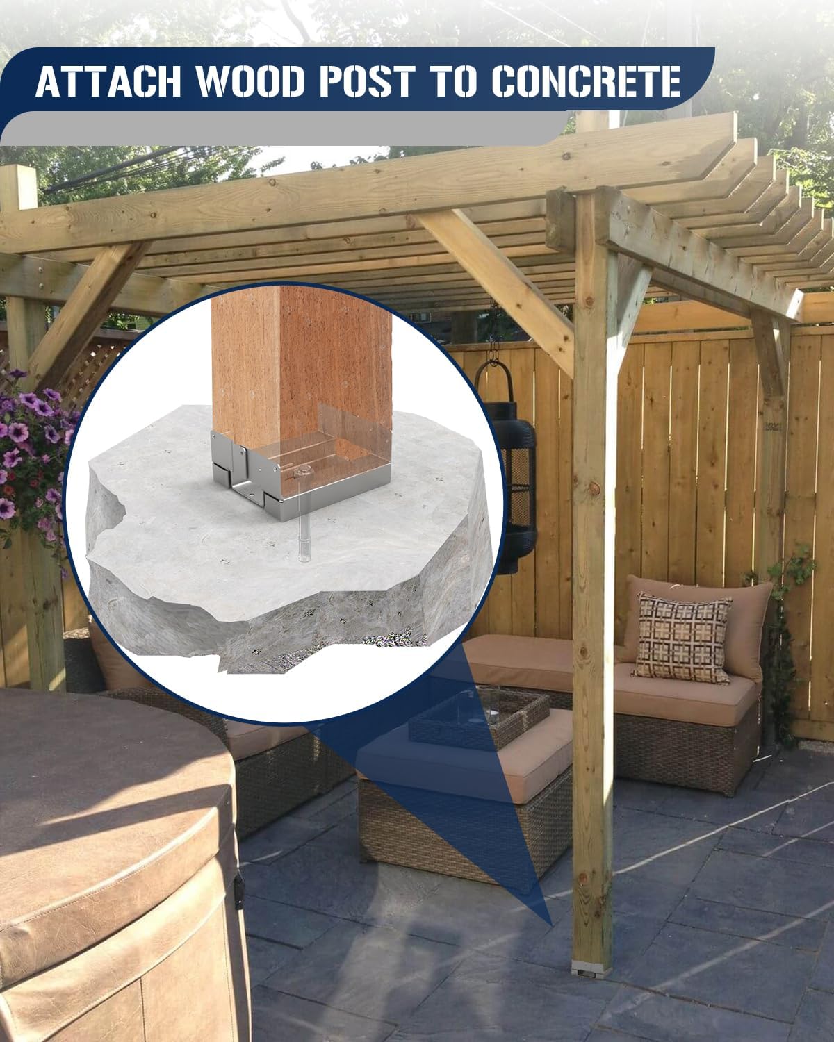 vikofan S180Z10 Base Post, Zincato, 10 pezzi - immagine 2